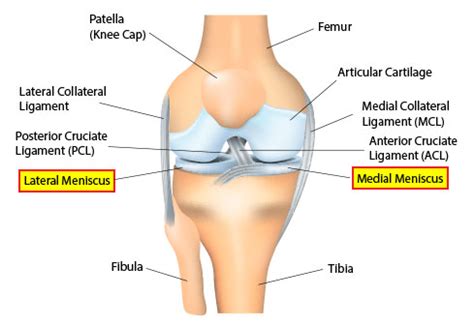 Meniscal Tear - Advanced Orthopedic & Sports Medicine Specialists