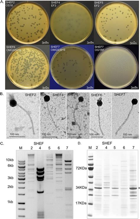 Isolation of E. faecalis bacteriophage and plaque morphology. (A ...