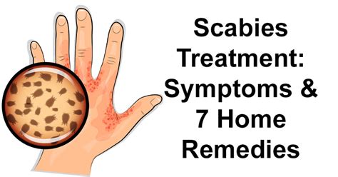 Scabies Treatment: Symptoms & 7 Home Remedies - David Avocado Wolfe