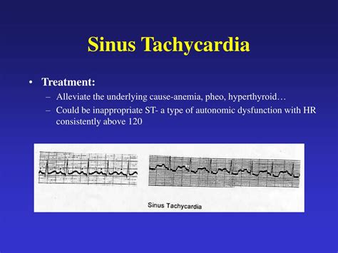 Icd 10 Diagnosis Code For Sinus Tachycardia