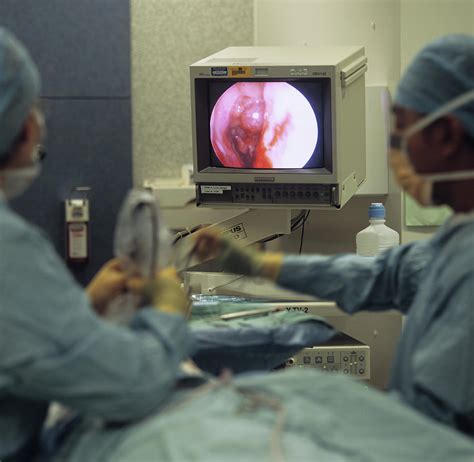 Nasal Polyp Surgery Photograph by Science Photo Library - Fine Art America