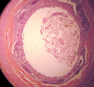 Appendix Histology - Appendix - histology slide