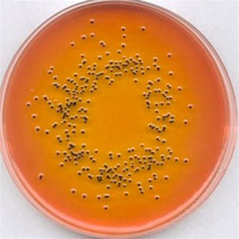 SS-Agar, for microbiology | 85640-500G | MILLIPORE | SLS