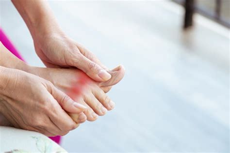 Steps to Take During a Gout Flare-Up: Great Lakes Foot and Ankle ...