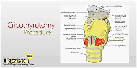 Cricothyrotomy Procedure