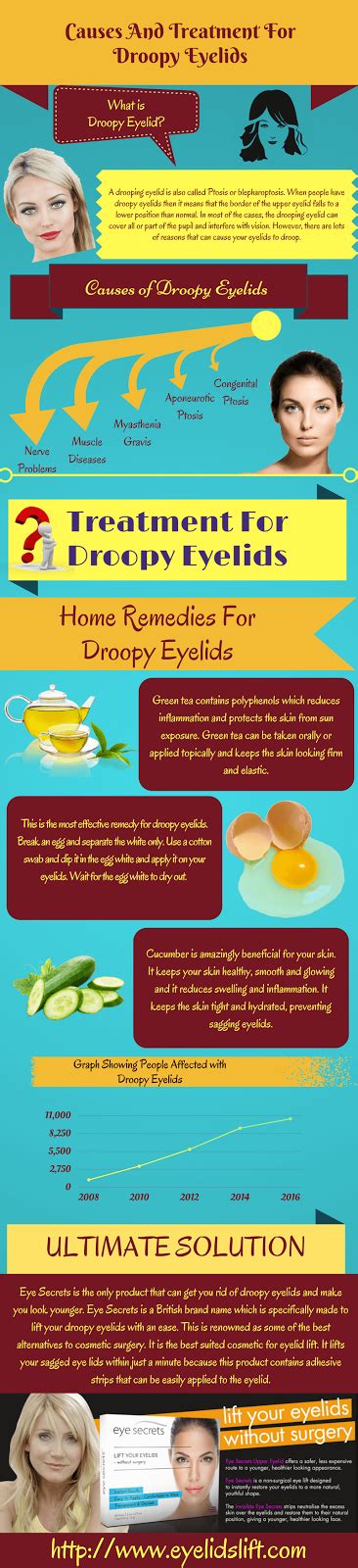 Causes and Treatment for Droopy Eyelids - Visulattic - Your ...