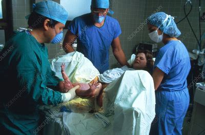 Birth Sequence - Stock Image - C017/2323 - Science Photo Library