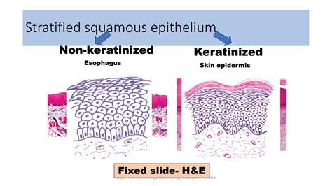 Stratified Squamous Epithelium Keratinized Vs Non Keratinized