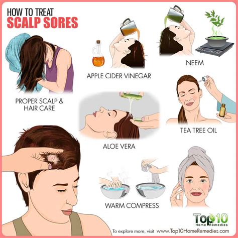 How to Treat Scalp Sores | Top 10 Home Remedies