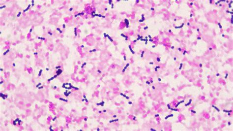 Mixed Gram-Positive And Gram-Negative Bacillus, Gram Stain Microscope ...