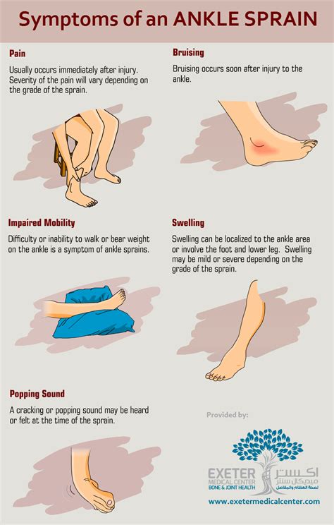 Ankle Sprains are a common injury that occur from over stretching or ...