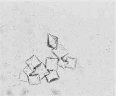 What Causes Calcium Oxalate Crystals In Urine In Dogs