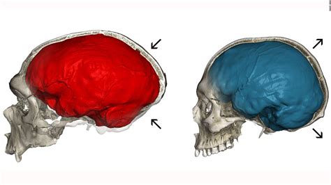 Neanderthal genes could explain the shape of our skulls, study finds - CNN