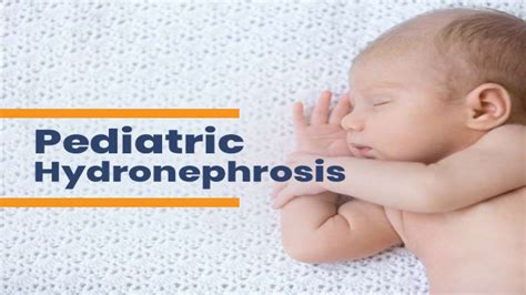 Paediatric Hydronephrosis: Causes, Types, Symptoms, Diagnosis And ...