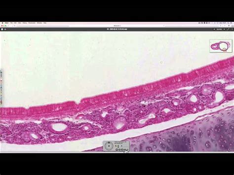 Tracheal Cartilage Histology