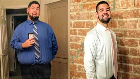 ‘I’m FINE.’ At 545 lbs, I was 25 years old and ‘invincible.’: Man ...