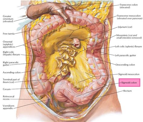 Sigmoid colon anatomy, location, function, polyps, diverticulosis & cancer