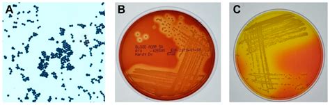 Staphylococcus Epidermidis Gram Stain