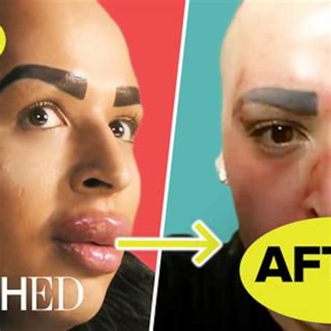 The Most Insane Lips on "Botched"