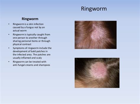 What are Common Causes of A Sore Scalp?