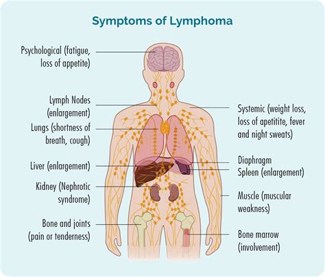 Symptoms of Lymphoma - Lymphoma Australia