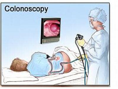 Colonoscopy - Procedure, Preparation, Test, Risks | Diseases Pictures