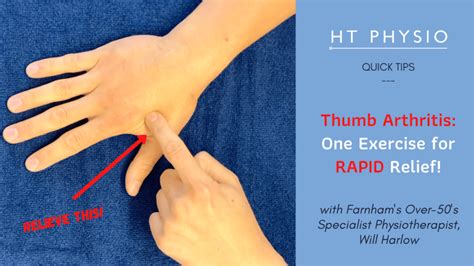 Thumb Arthritis: One Exercise for Rapid Relief | Quick Tips - HT Physio