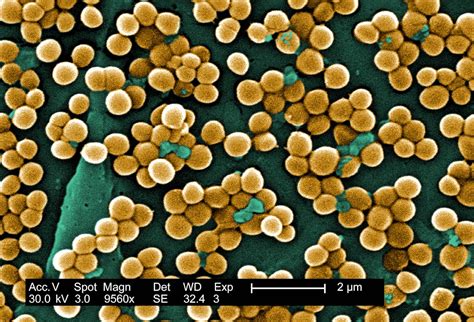 1928 - Staphylococcus aureus