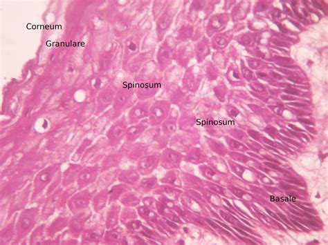 into the roots: Stratified squamous epithelium