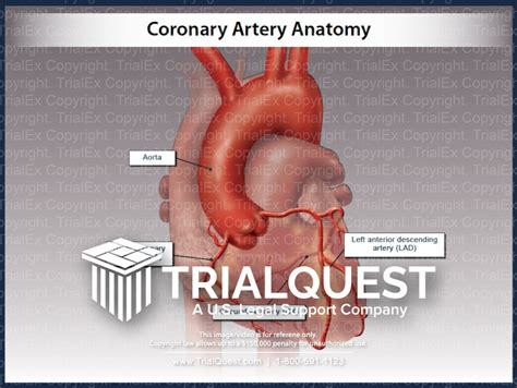 Coronary Artery Anatomy - TrialExhibits Inc.