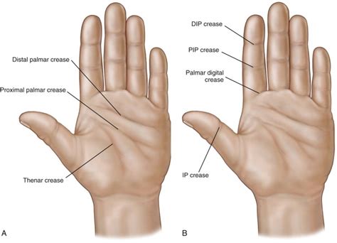 Anatomy and Biomechanics of the Hand and Wrist | Musculoskeletal Key