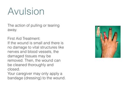 Avulsion Wound Definition