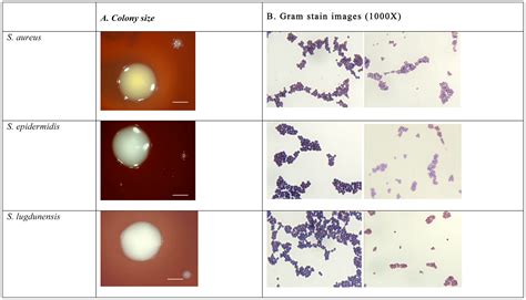 Staphylococcus Epidermidis Gram Stain