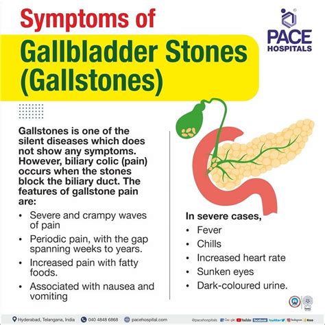 Gallstones, Gallbladder Stones – Symptoms, Causes, Complications