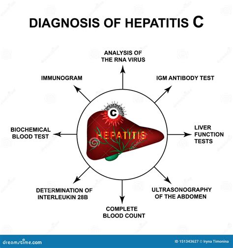 Diagnosis of Hepatitis C. World Hepatitis Day. Infographics. Vector ...