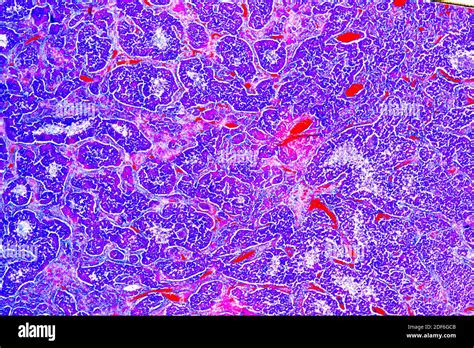 Pituitary gland microscope hi-res stock photography and images - Alamy