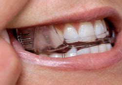 Do Sleep Apnea Mouthpieces Work? Where To Buy, Problems