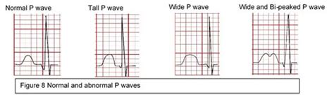 Pediatric Cardiology