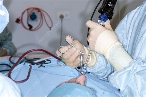 Nasal polyp surgery - Stock Image - C008/7840 - Science Photo Library