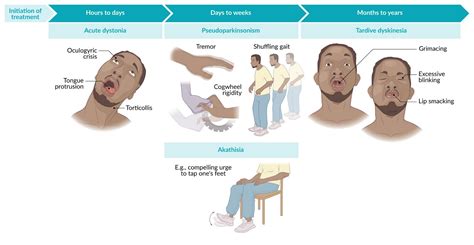 Can Benadryl Trigger Extrapyramidal Symptoms?