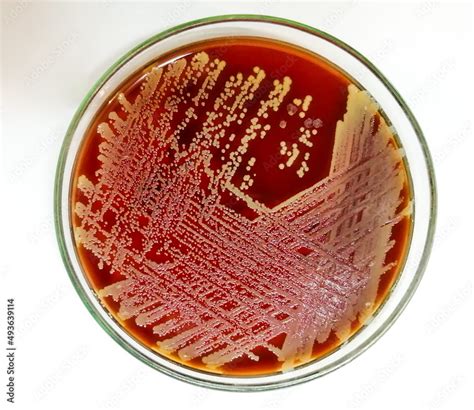 Staph aureus: Gram positive bacteria. Staphylococcus or streptococcus ...