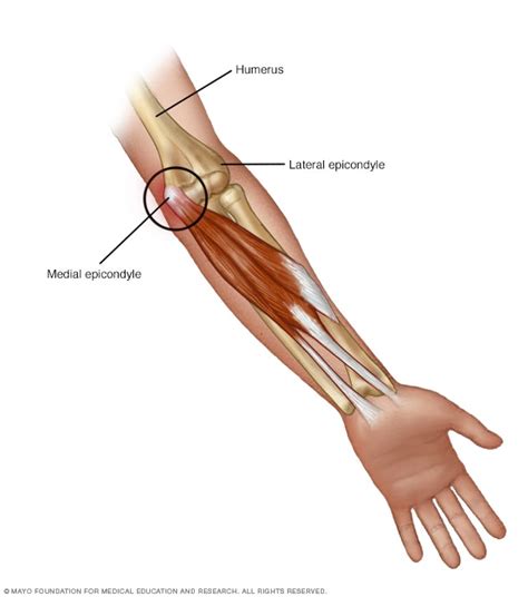 Golfer's elbow - Symptoms and causes - Mayo Clinic