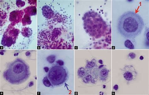 Mesothelial Cells