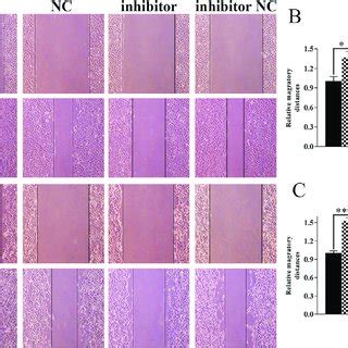 Result of wound healing assay. The wound healing images in 5637 and ...