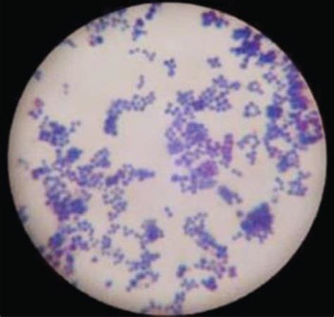 (a) Gram-positive cocci arranged in irregular clusters (Staphylococcus ...