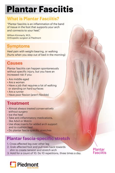 Infographic: Plantar fasciitis