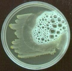 8: Catalase test (positive) | Download Scientific Diagram