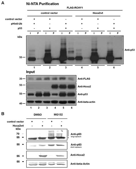 (A) Ubiquitination assays for p53. HEK293T cells were co-transfected ...