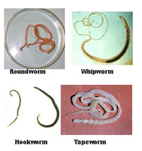 Worm Types Intestinal Worms Otherwise Known As Pesky Little, 43% OFF