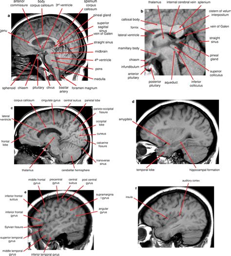 Anatomy Of The Brain Mri Mri Brain Brain Anatomy Atlas Anatomy | Images ...